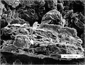 電子顕微鏡7,000倍